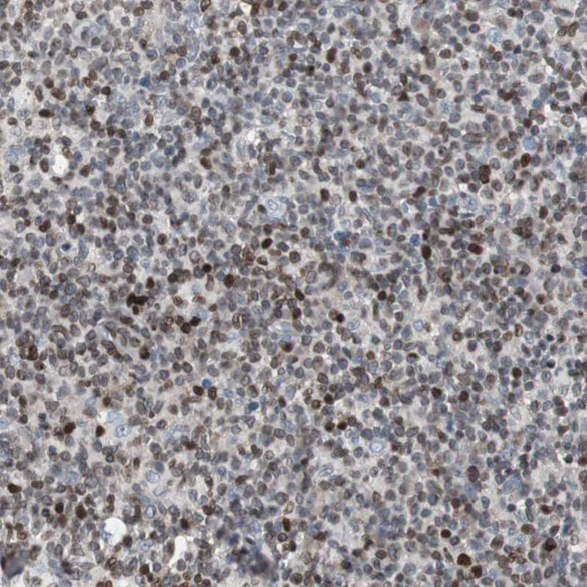 ZNF396 Antibody in Immunohistochemistry (Paraffin) (IHC (P))