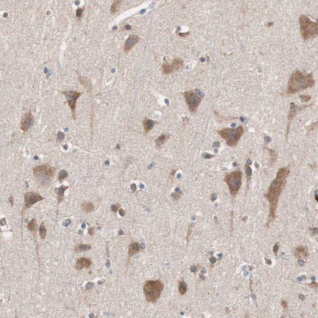 GLYCTK Antibody in Immunohistochemistry (Paraffin) (IHC (P))