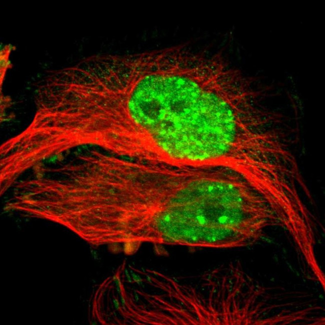 MDC1 Antibody in Immunocytochemistry (ICC/IF)