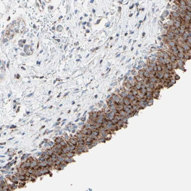HK1 Antibody in Immunohistochemistry (Paraffin) (IHC (P))