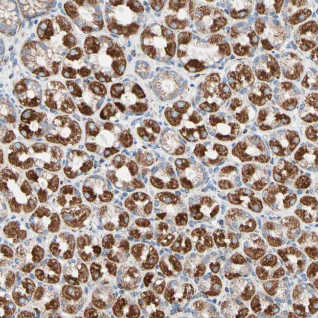 HK1 Antibody in Immunohistochemistry (Paraffin) (IHC (P))