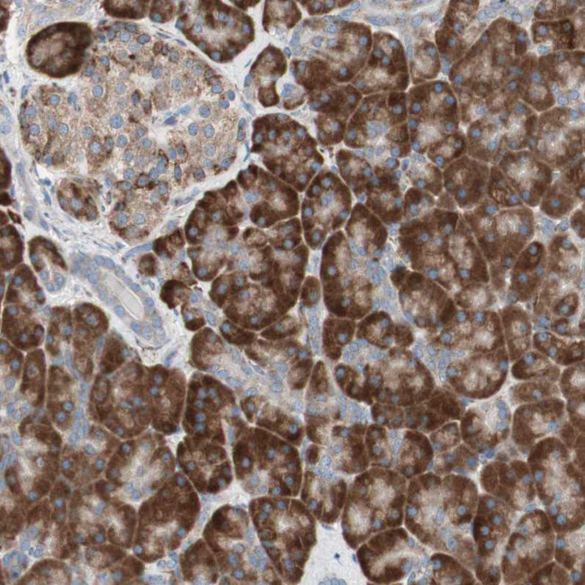 P4HTM Antibody in Immunohistochemistry (Paraffin) (IHC (P))