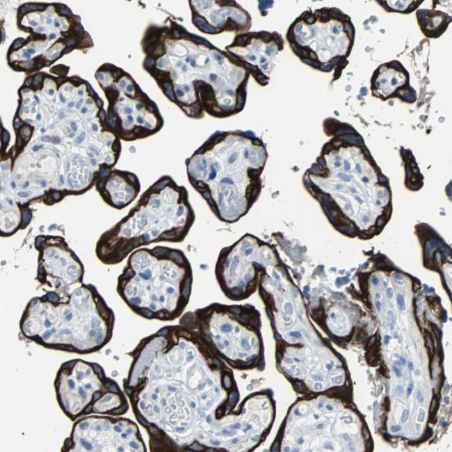 Cytokeratin 7 Antibody in Immunohistochemistry (Paraffin) (IHC (P))