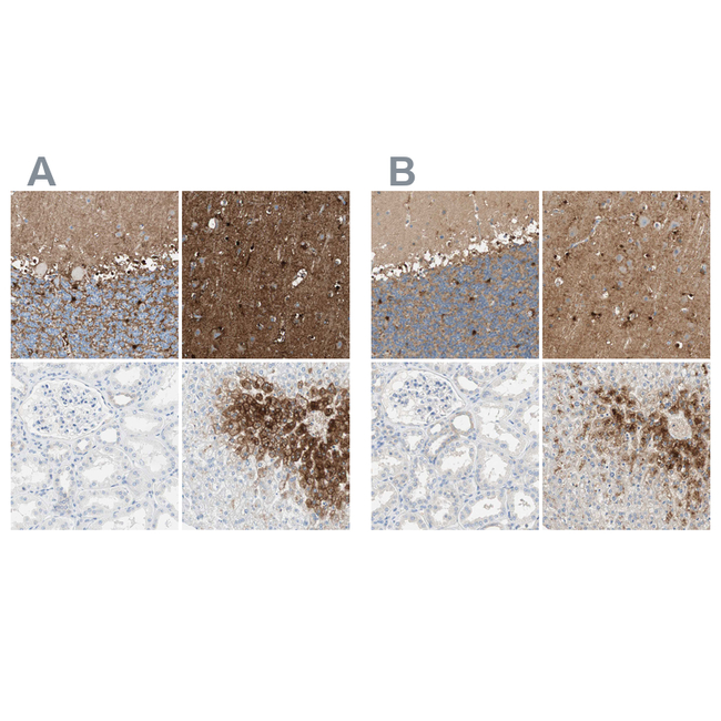 Glutamine Synthetase Antibody in Immunohistochemistry (Paraffin) (IHC (P))
