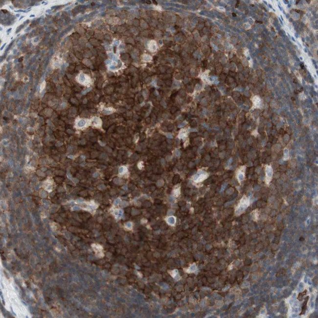 HPK1 Antibody in Immunohistochemistry (Paraffin) (IHC (P))