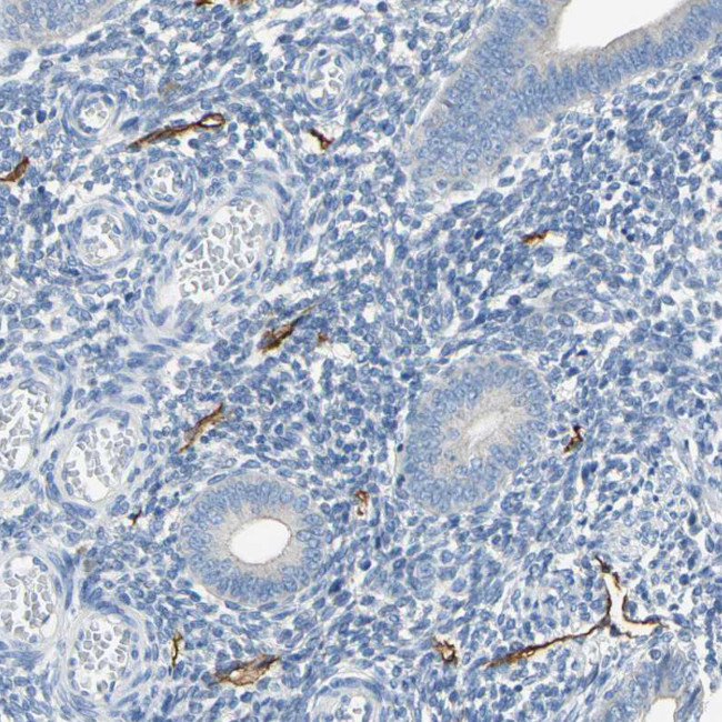 Podoplanin Antibody in Immunohistochemistry (Paraffin) (IHC (P))