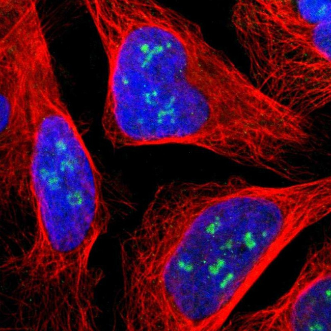 JMJD2A Antibody in Immunocytochemistry (ICC/IF)