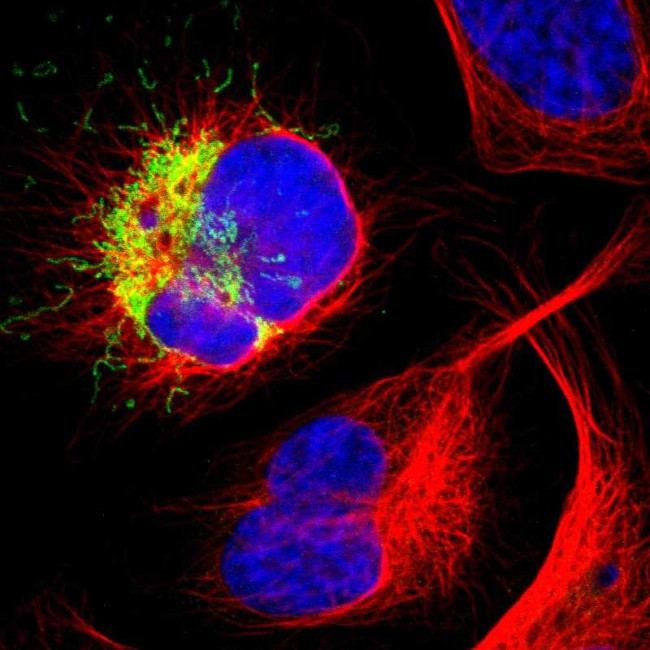IL18R1 Antibody in Immunocytochemistry (ICC/IF)