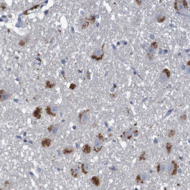 TNF beta Antibody in Immunohistochemistry (Paraffin) (IHC (P))