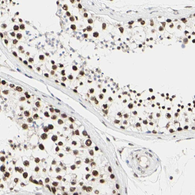 PRMT3 Antibody in Immunohistochemistry (Paraffin) (IHC (P))
