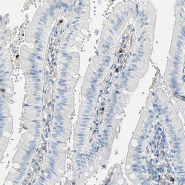 CLEC4A Antibody in Immunohistochemistry (Paraffin) (IHC (P))