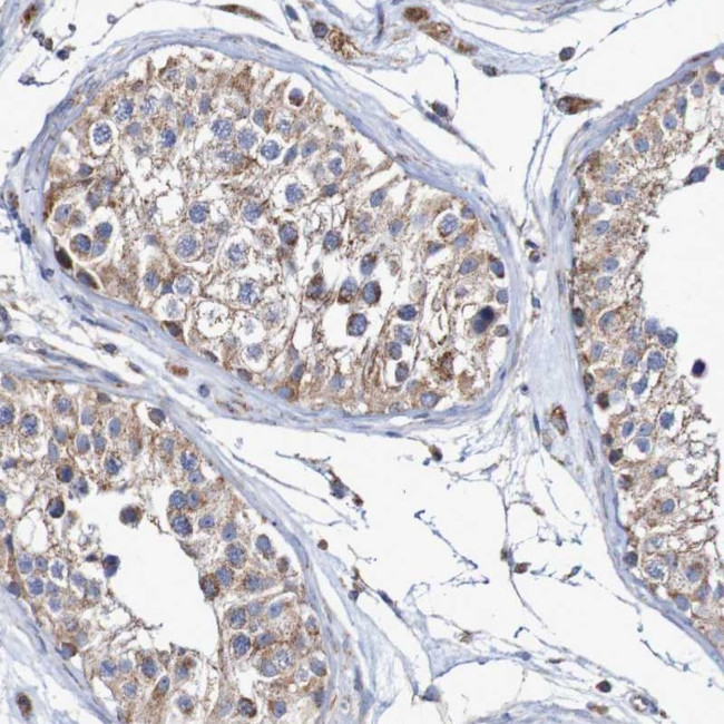MMEL1 Antibody in Immunohistochemistry (Paraffin) (IHC (P))