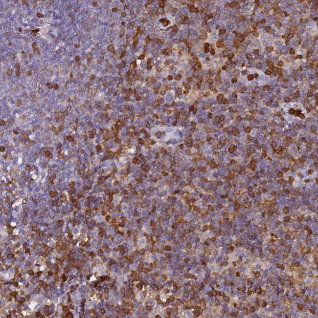 S100A4 Antibody in Immunohistochemistry (Paraffin) (IHC (P))