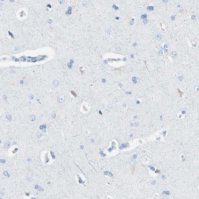 Thyroid Peroxidase Antibody in Immunohistochemistry (Paraffin) (IHC (P))
