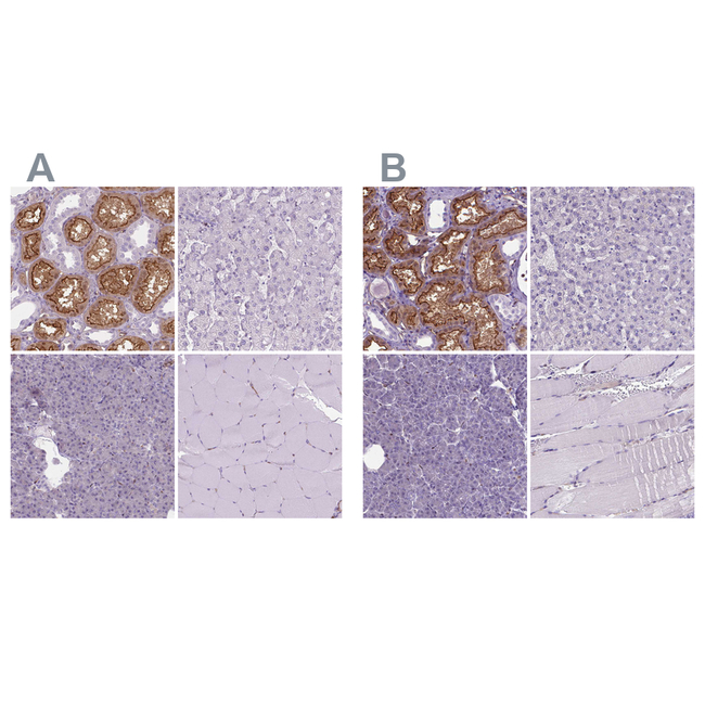 CLIC4 Antibody in Immunohistochemistry (Paraffin) (IHC (P))