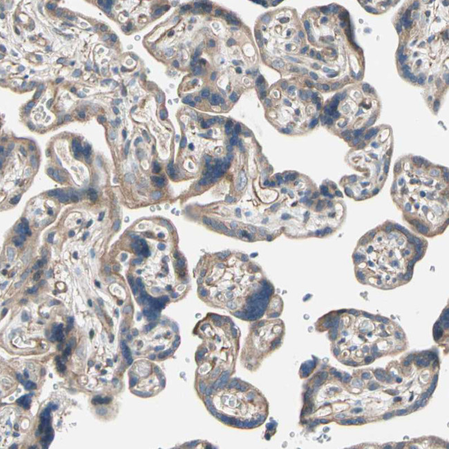 LIMK2 Antibody in Immunohistochemistry (Paraffin) (IHC (P))