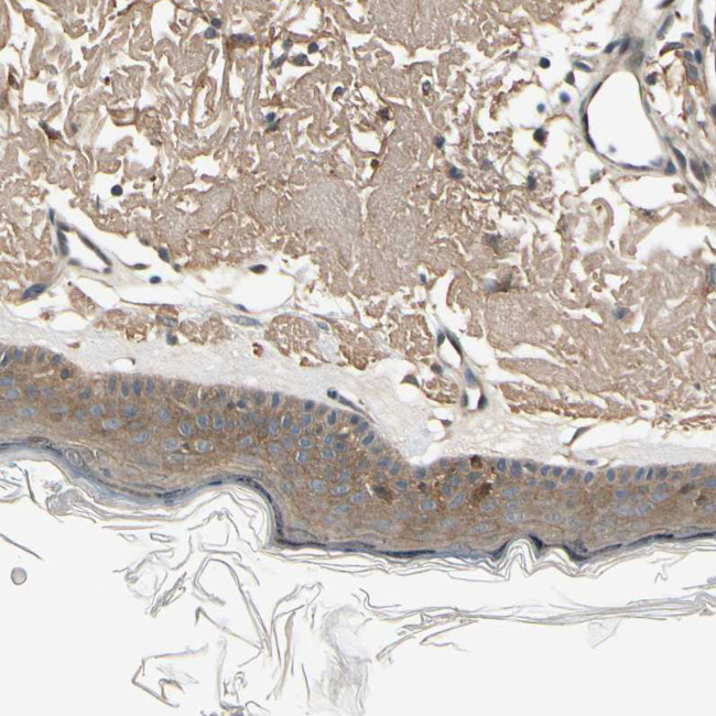 EphB3 Antibody in Immunohistochemistry (Paraffin) (IHC (P))