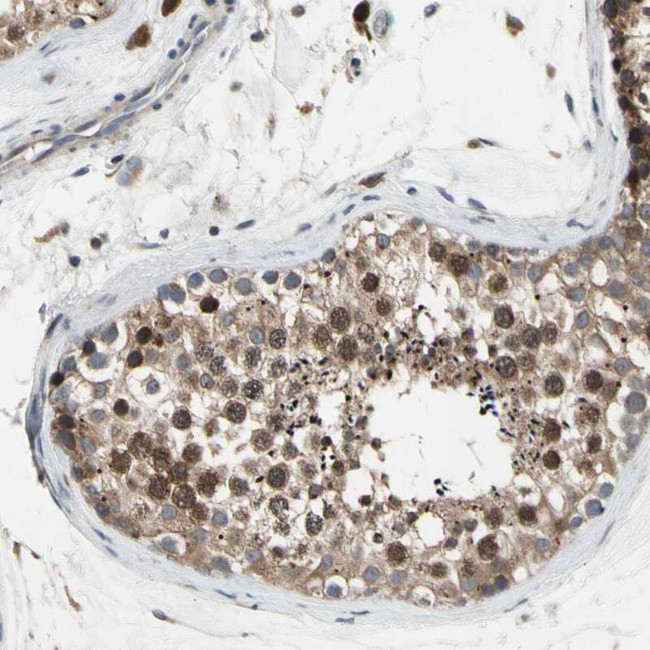 MMEL1 Antibody in Immunohistochemistry (Paraffin) (IHC (P))