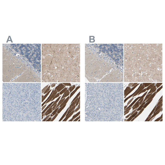 CACNA2D1 Antibody in Immunohistochemistry (Paraffin) (IHC (P))