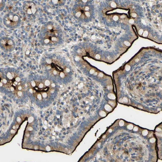 RhoGAP Antibody in Immunohistochemistry (Paraffin) (IHC (P))