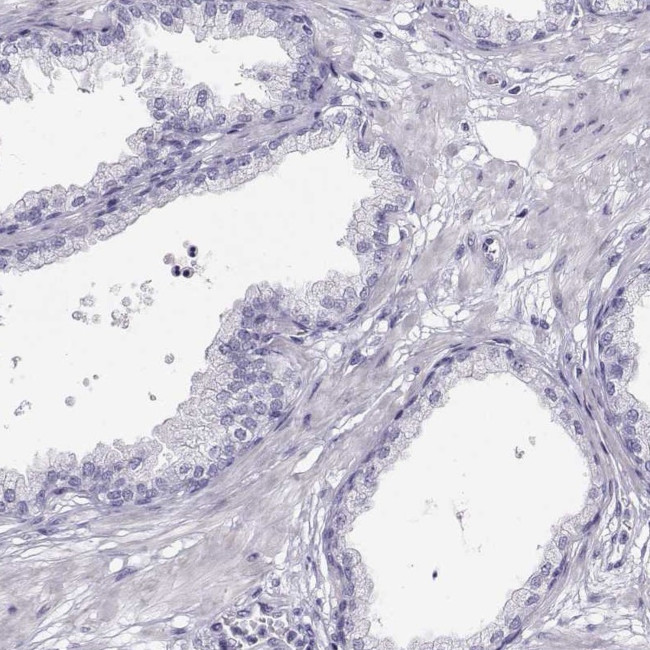 alpha Actinin 2 Antibody in Immunohistochemistry (Paraffin) (IHC (P))