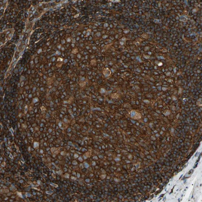 ARPC2 Antibody in Immunohistochemistry (Paraffin) (IHC (P))