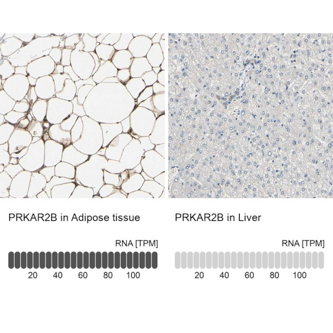 PRKAR2B Antibody