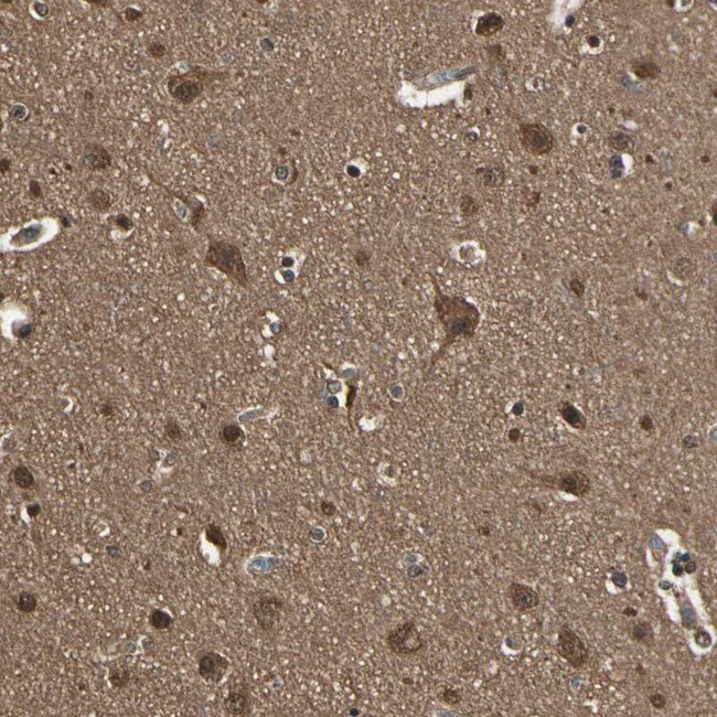 14-3-3 epsilon Antibody in Immunohistochemistry (Paraffin) (IHC (P))