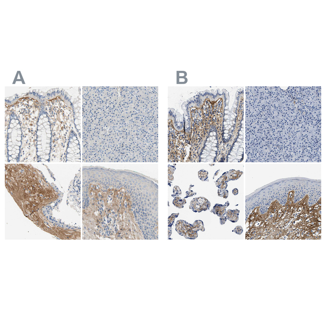 TGFBI Antibody in Immunohistochemistry (Paraffin) (IHC (P))