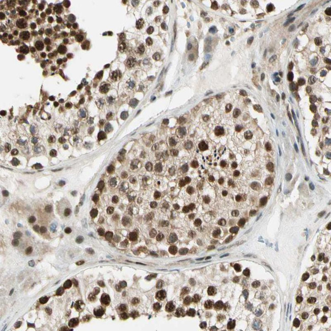 DAXX Antibody in Immunohistochemistry (Paraffin) (IHC (P))