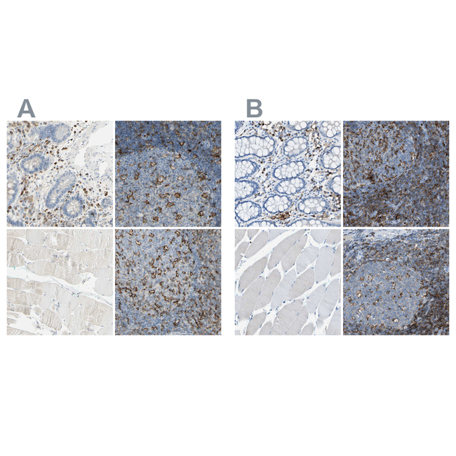 CD18 Antibody in Immunohistochemistry (Paraffin) (IHC (P))