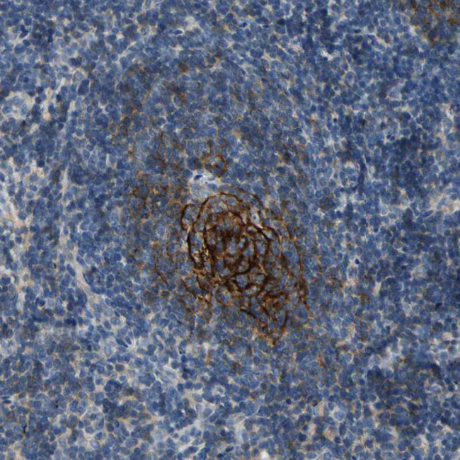 CD23 Antibody in Immunohistochemistry (Paraffin) (IHC (P))