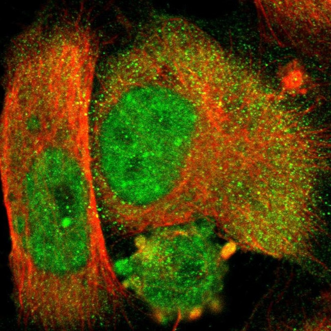 NUAK2 Antibody in Immunocytochemistry (ICC/IF)