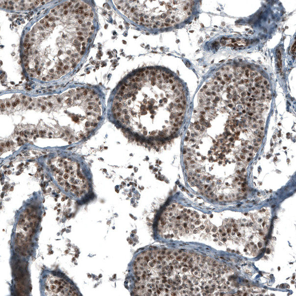 SOX7 Antibody in Immunohistochemistry (Paraffin) (IHC (P))