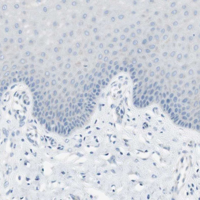 CDHR5 Antibody in Immunohistochemistry (Paraffin) (IHC (P))