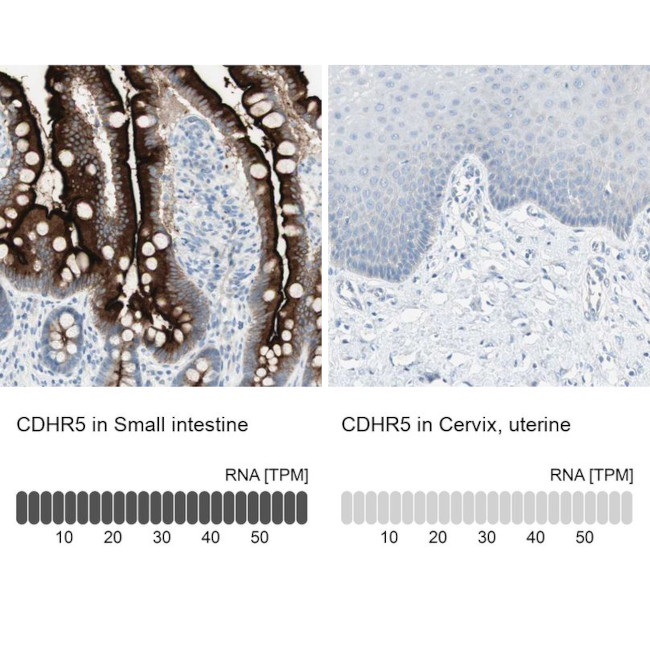 CDHR5 Antibody