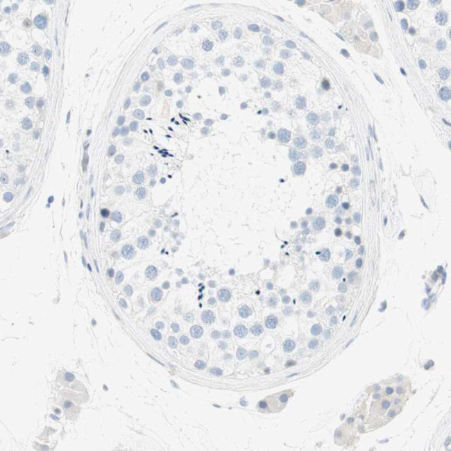 CDHR5 Antibody in Immunohistochemistry (Paraffin) (IHC (P))