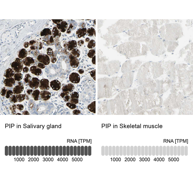 GCDFP-15 Antibody in Immunohistochemistry (Paraffin) (IHC (P))