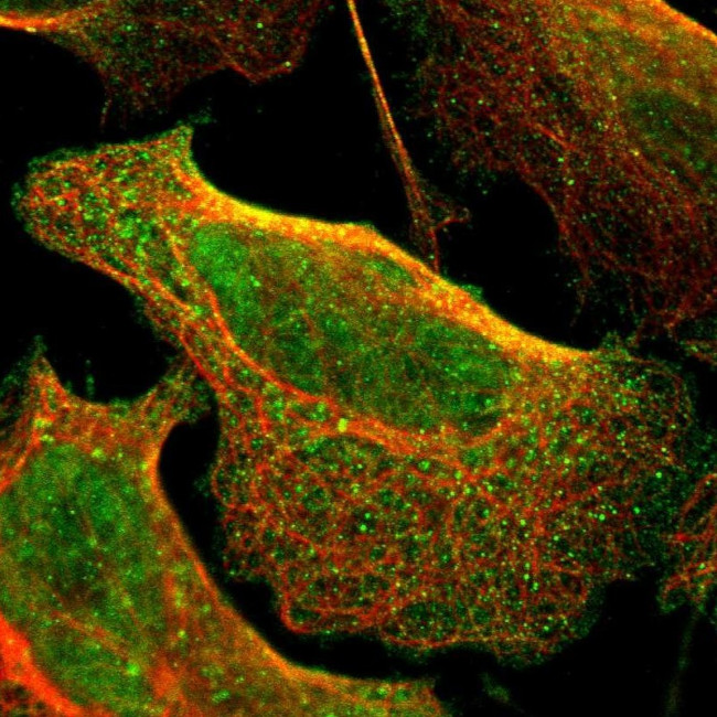 CD79b Antibody in Immunocytochemistry (ICC/IF)