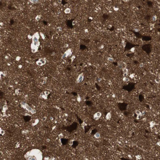 MAPRE3 Antibody in Immunohistochemistry (Paraffin) (IHC (P))