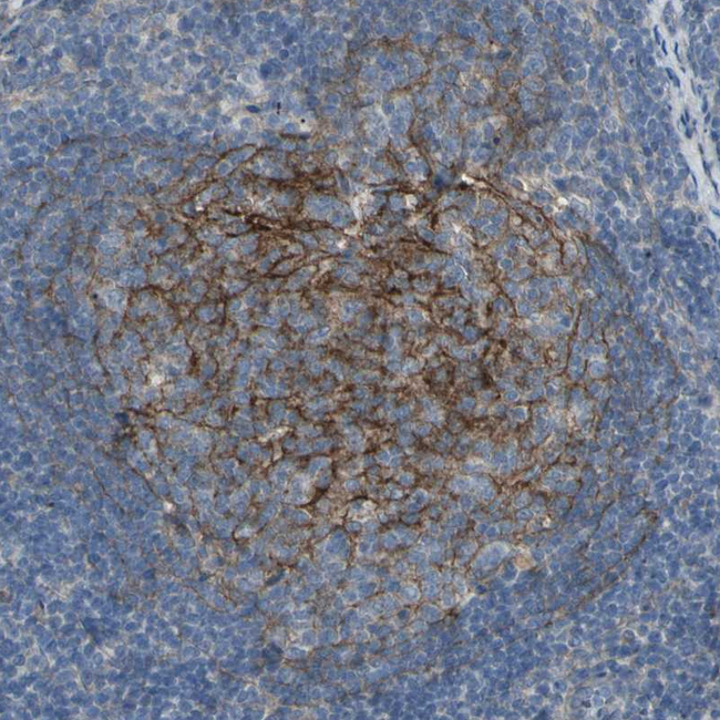 B7-H3 Antibody in Immunohistochemistry (Paraffin) (IHC (P))