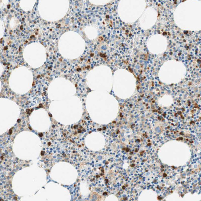 CD63 Antibody in Immunohistochemistry (Paraffin) (IHC (P))