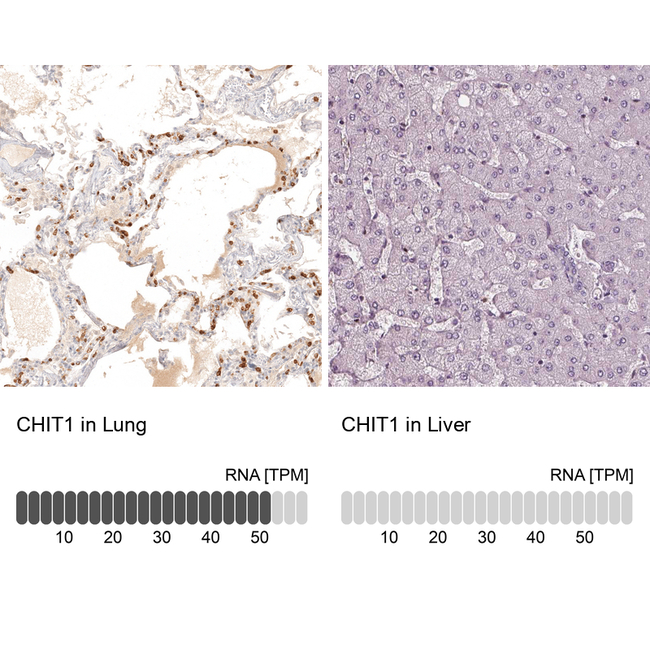 Chitotriosidase Antibody in Immunohistochemistry (Paraffin) (IHC (P))