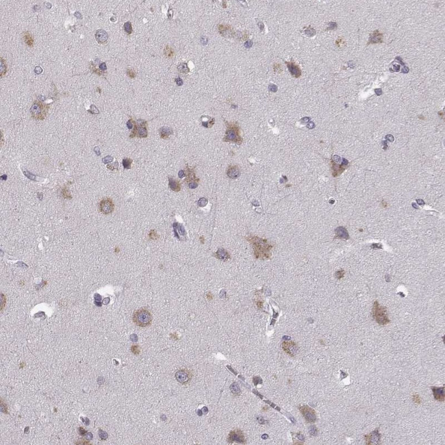 FAM234B Antibody in Immunohistochemistry (Paraffin) (IHC (P))
