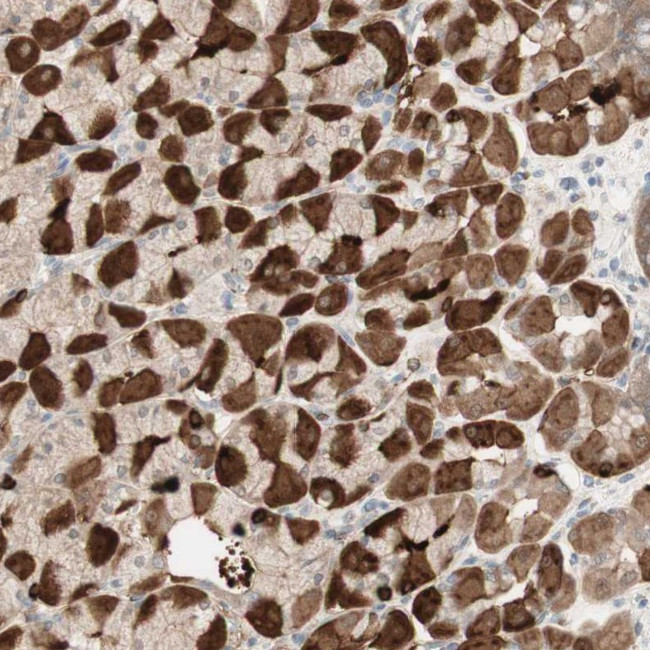 MUC3 Antibody in Immunohistochemistry (Paraffin) (IHC (P))