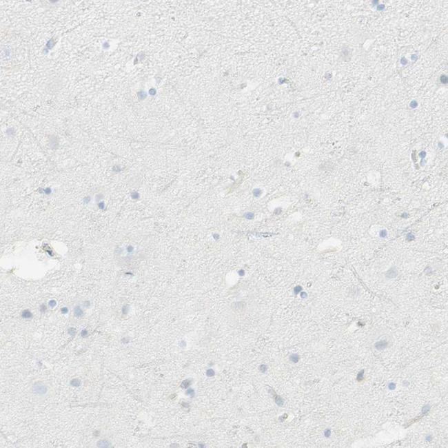 HLA-DPB1 Antibody in Immunohistochemistry (Paraffin) (IHC (P))