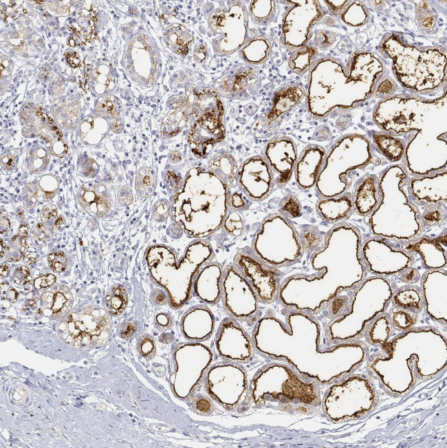 BTN1A1 Antibody in Immunohistochemistry (Paraffin) (IHC (P))