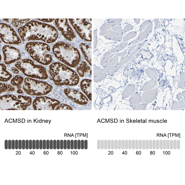 ACMSD Antibody in Immunohistochemistry (Paraffin) (IHC (P))