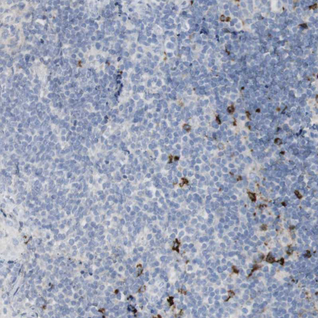 Langerin Antibody in Immunohistochemistry (Paraffin) (IHC (P))