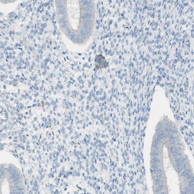 ART3 Antibody in Immunohistochemistry (Paraffin) (IHC (P))